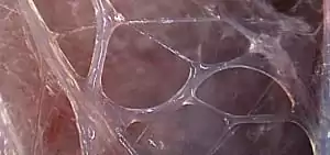 A close-up view of fascia tissue