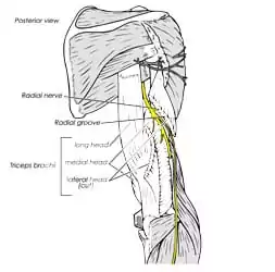 nerve entrapment