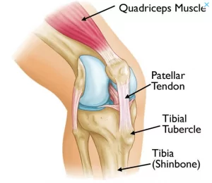 Osgood Schlatter disease/injury